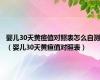 婴儿30天黄疸值对照表怎么自测（婴儿30天黄疸值对照表）