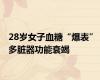 28岁女子血糖“爆表” 多脏器功能衰竭