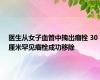 医生从女子血管中拽出瘤栓 30厘米罕见瘤栓成功移除